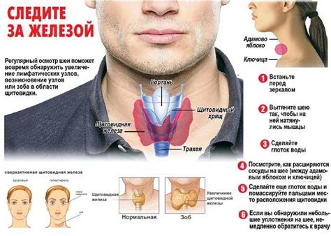 Заболевания щитовидной потенция у мужчин